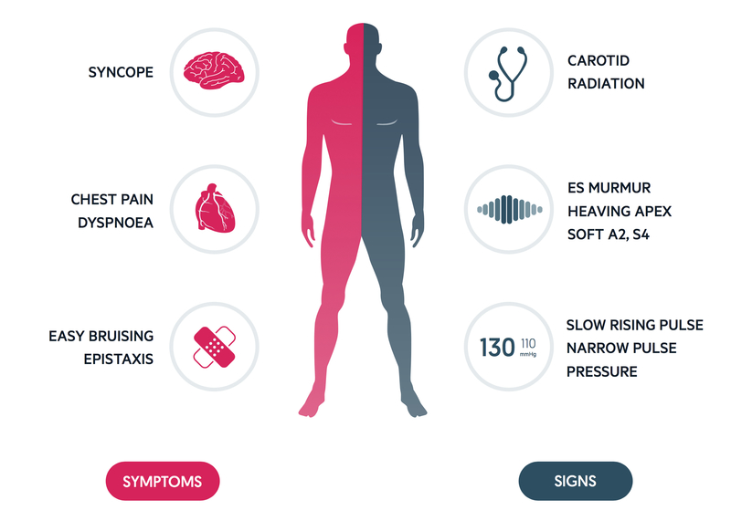 Aorta Heart Valve Symptoms