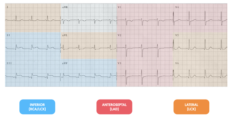 Pulsenotes  ST segment and T waves