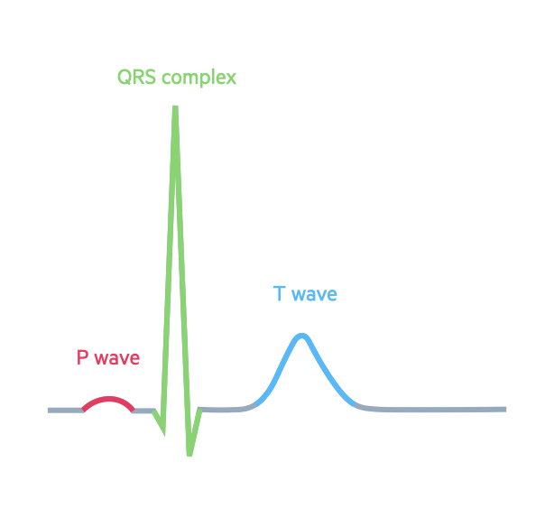 Pulsenotes  ST segment and T waves