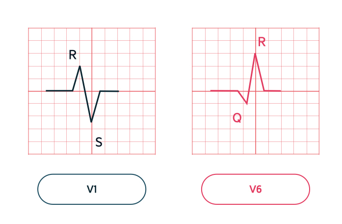 Pulsenotes  ST segment and T waves