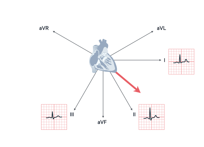 heart axis