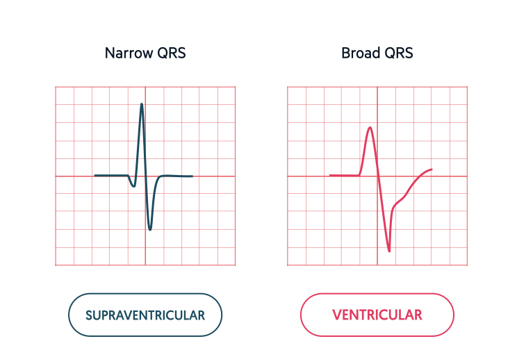 Heart rate versus heart rhythm