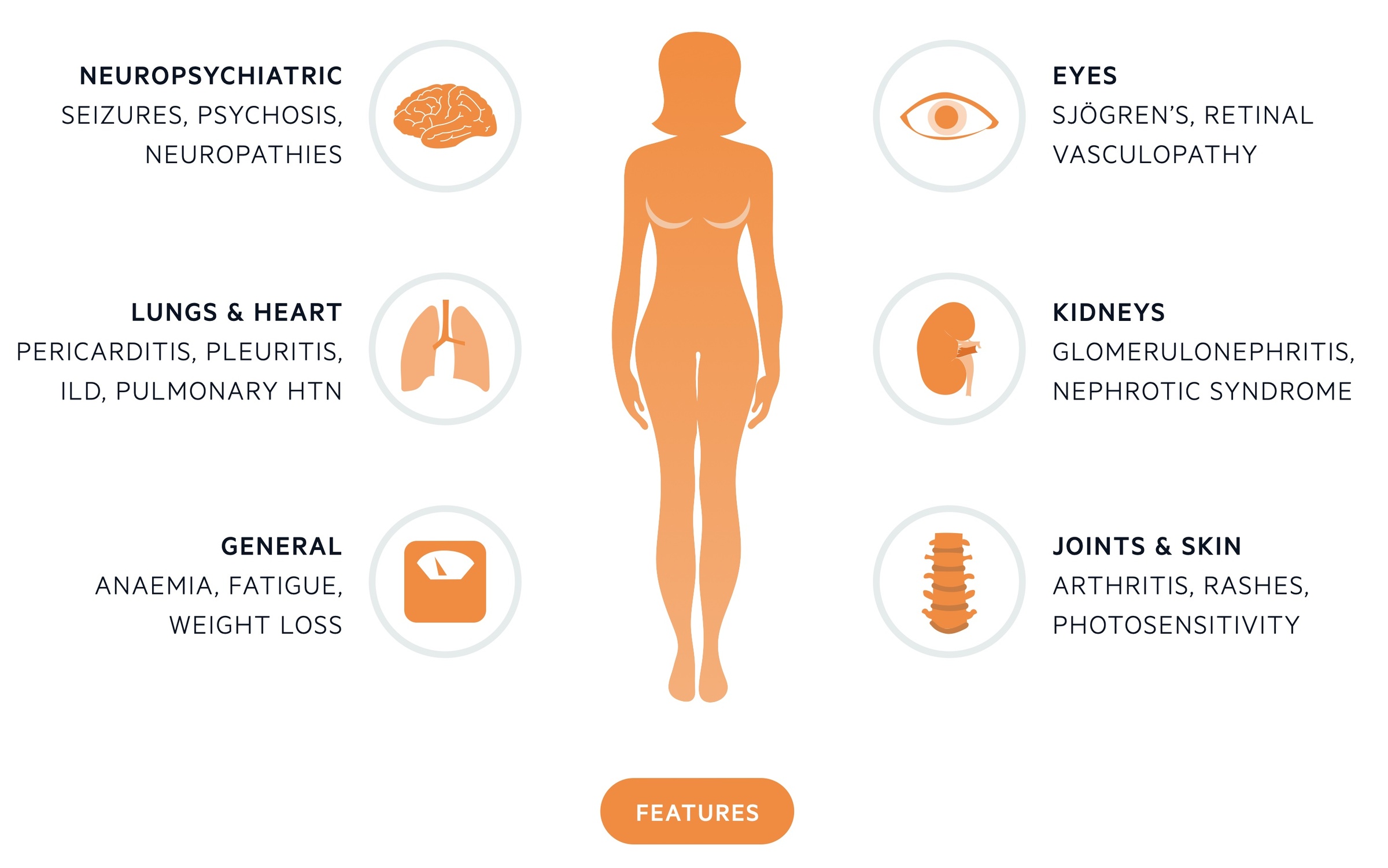 Clinical features of systemic lupus erythematosus (SLE)