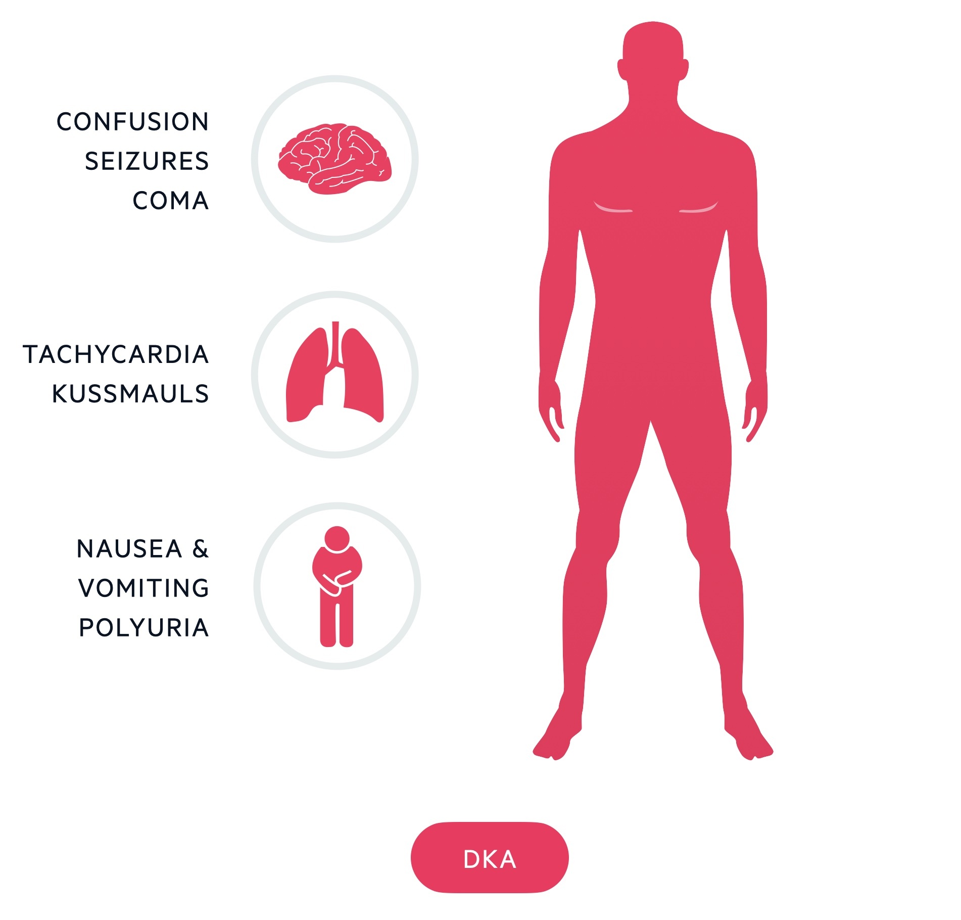 Clinical features of DKA