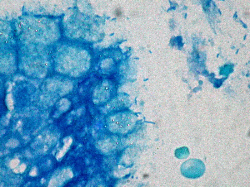 H. pylori Giemsa stain