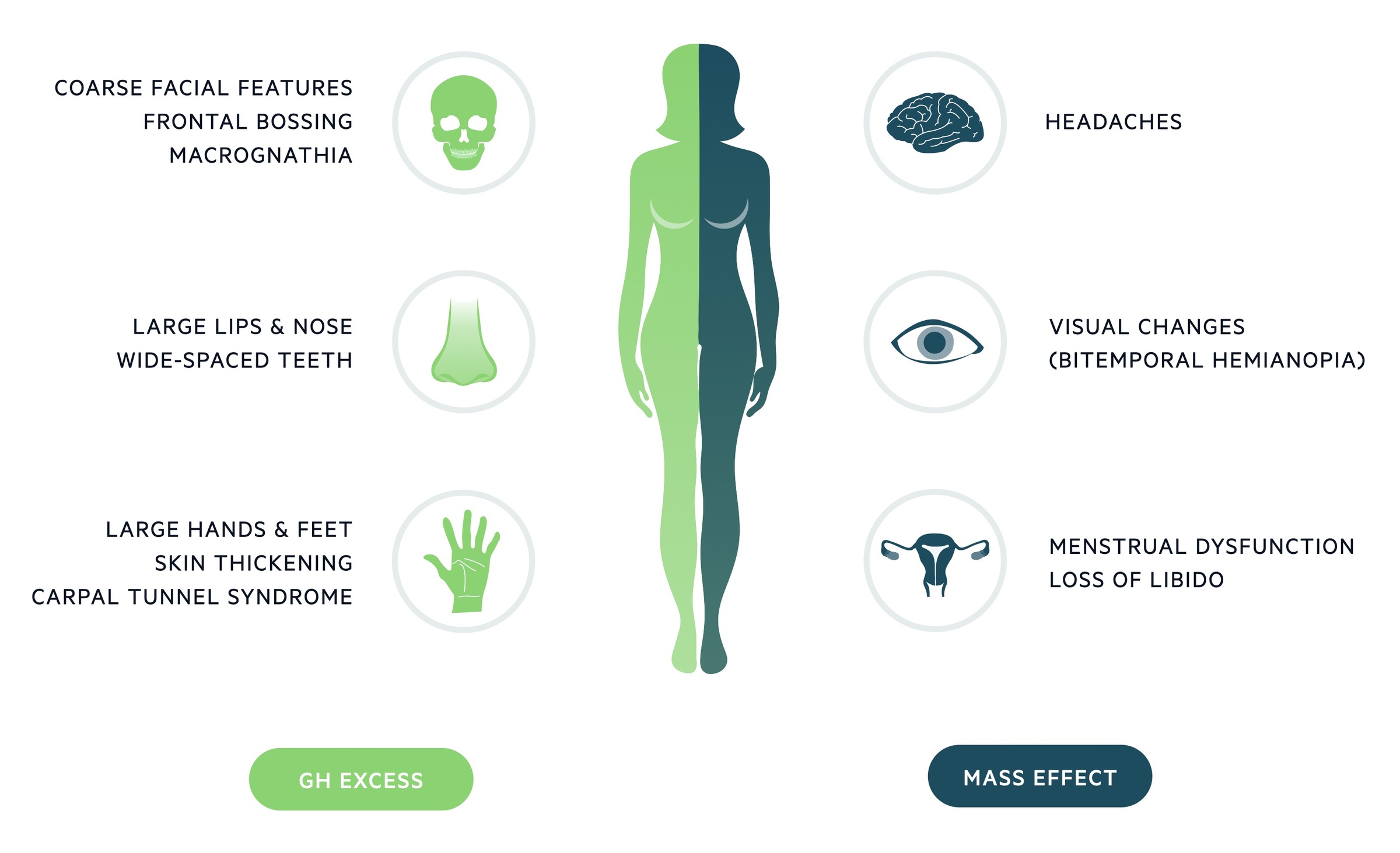 Clinical features of acromegaly