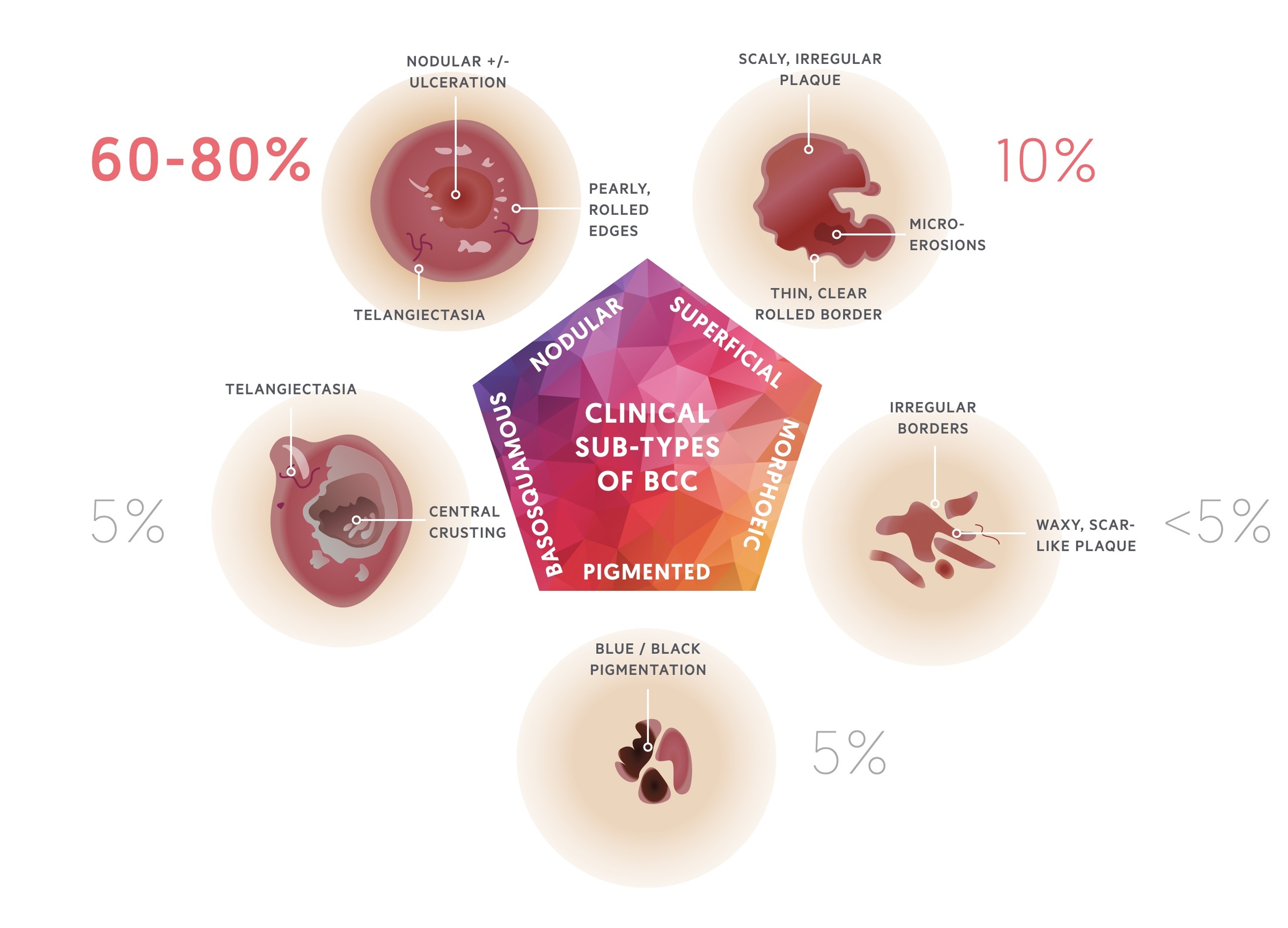 Clinical sub-types of BCC