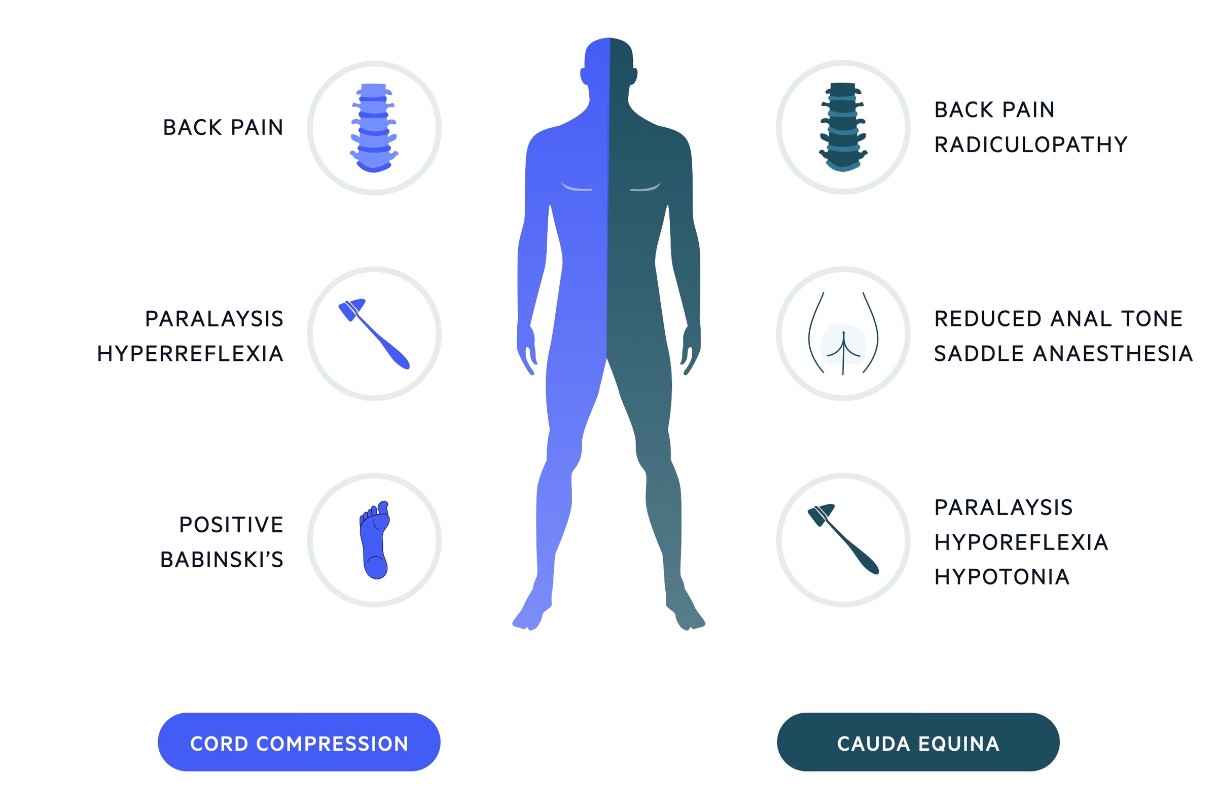 Clinical features of cord compression and cauda equina