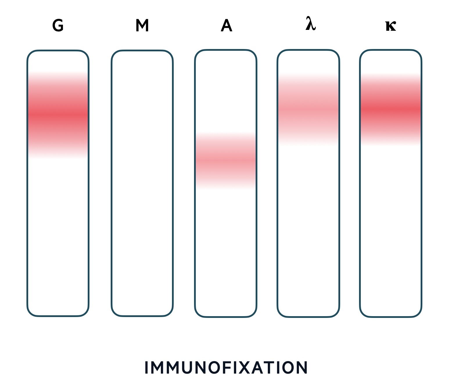 Immunofixation