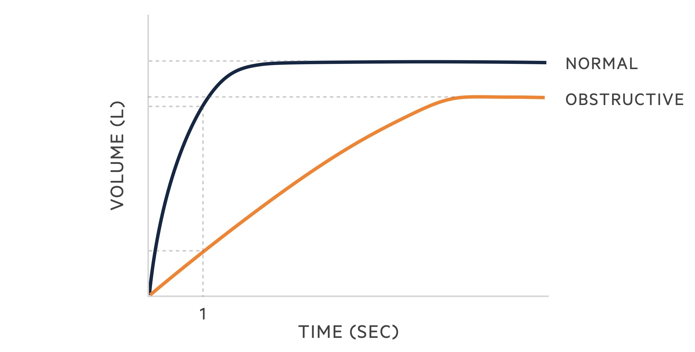 Obstructive lung disease spirometry