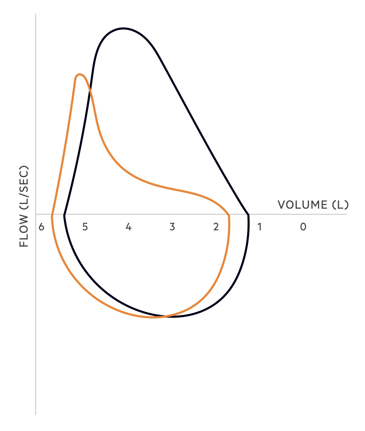 Obstructive flow-volume loop