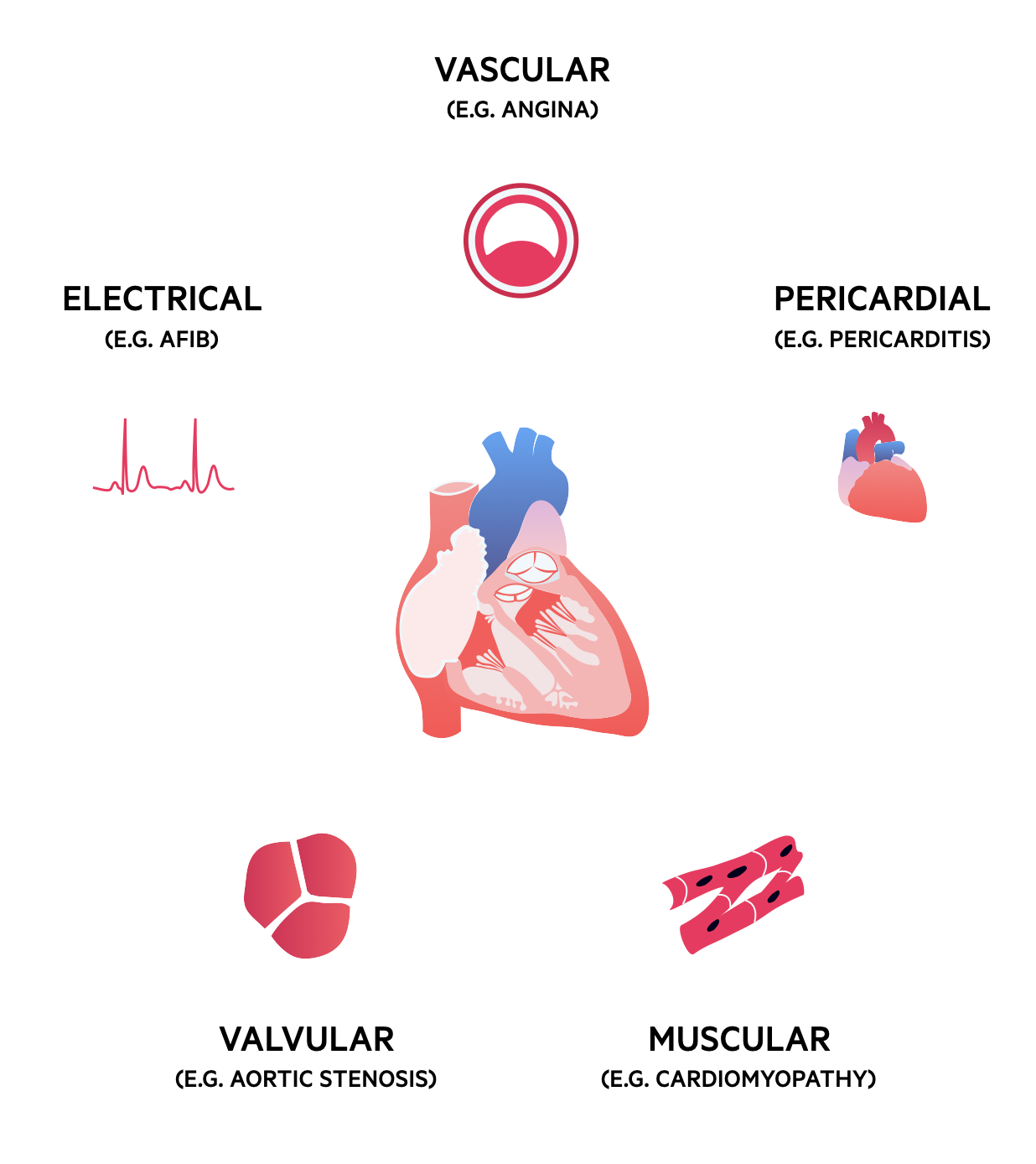 Categorisation of cardiac disease